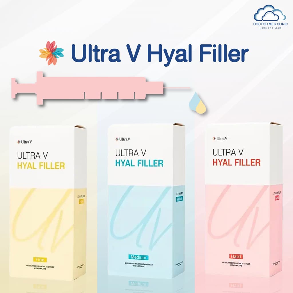 Ultra V Hyal Filler